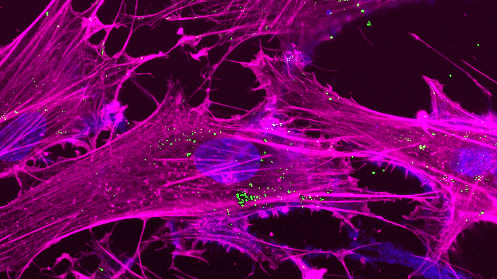 A microscopic look into a cell with MoS₂ nanoparticles. | Image: Courtesy of Akhilesh Gaharwar.